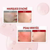 SNAIL TRUECICA MIRACLE REPAIR SERUM 50ML